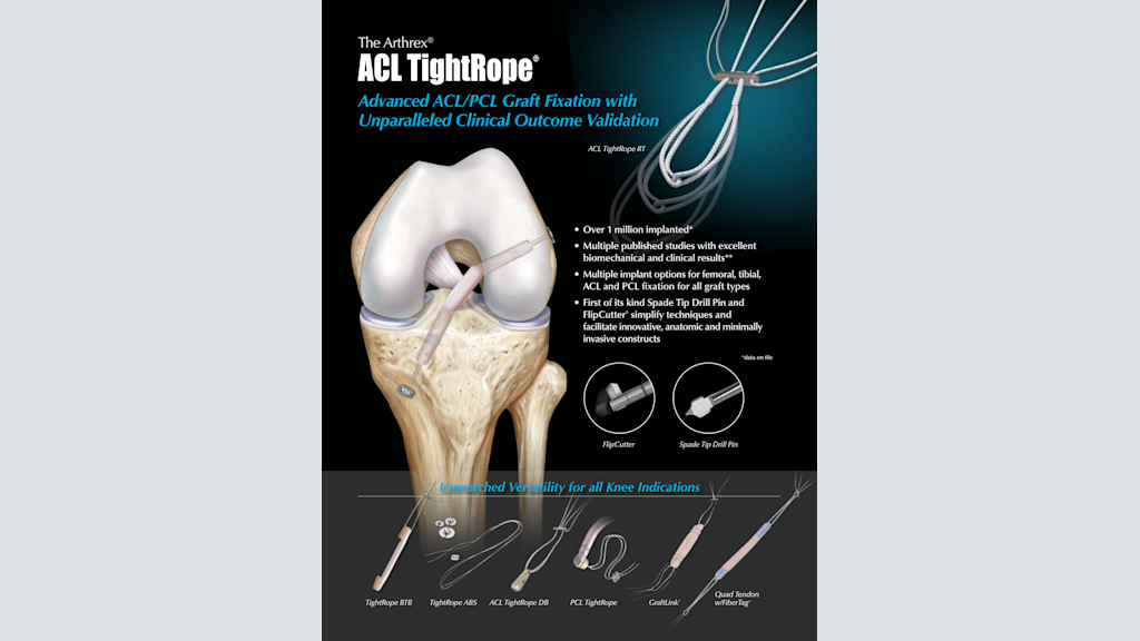 The Arthrex® ACL TightRope® - Advanced ACL/PCL Graft Fixation with Unparalleled Clinical Outcome Validation