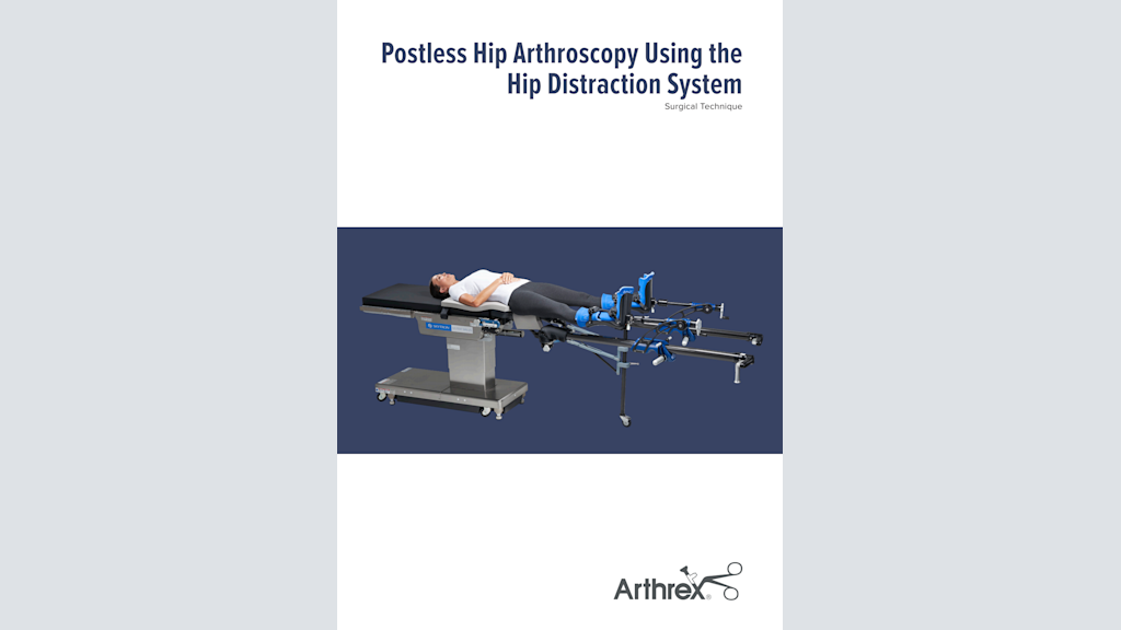 Postless Hip Arthroscopy Using the Hip Distraction System