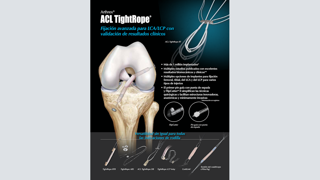 Arthrex ACL TightRope® - ￼Fijación avanzada para LCA/LCP con incomparables resultados clínicos validados
