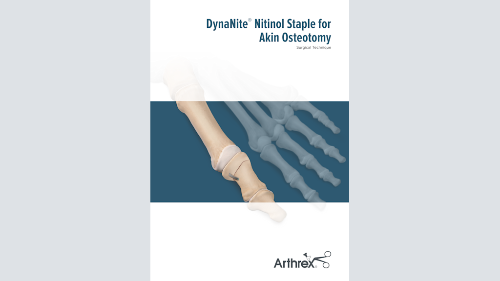 DynaNite® Nitinol Staple for Akin Osteotomy