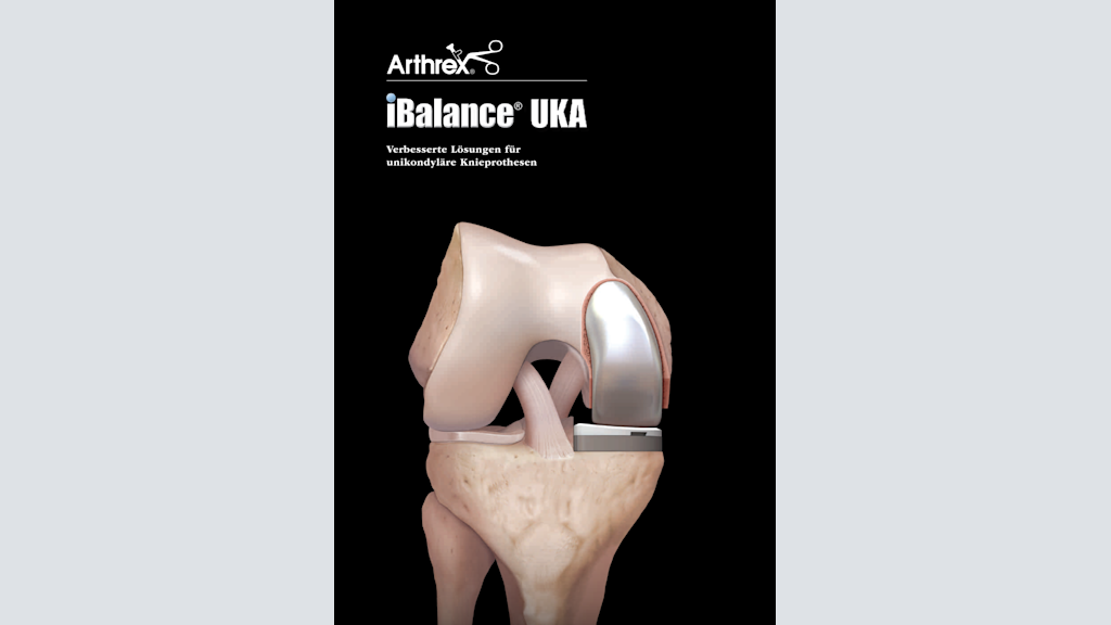 iBalance® UKA Verbesserte Lösungen für unikondyläre Knieprothesen