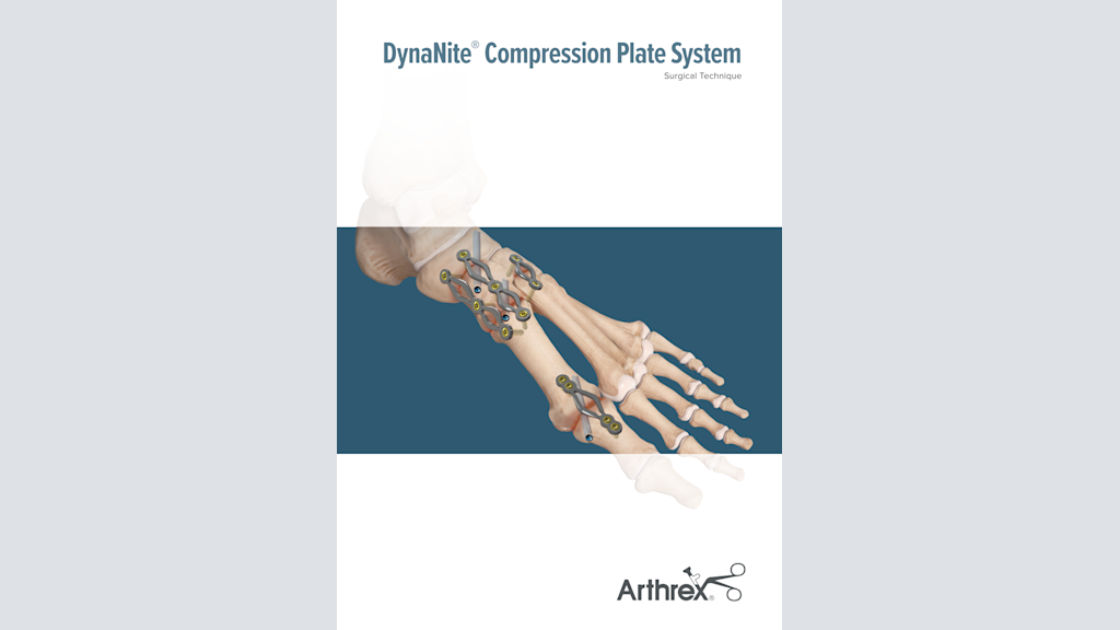 DynaNite® Compression Plate System
