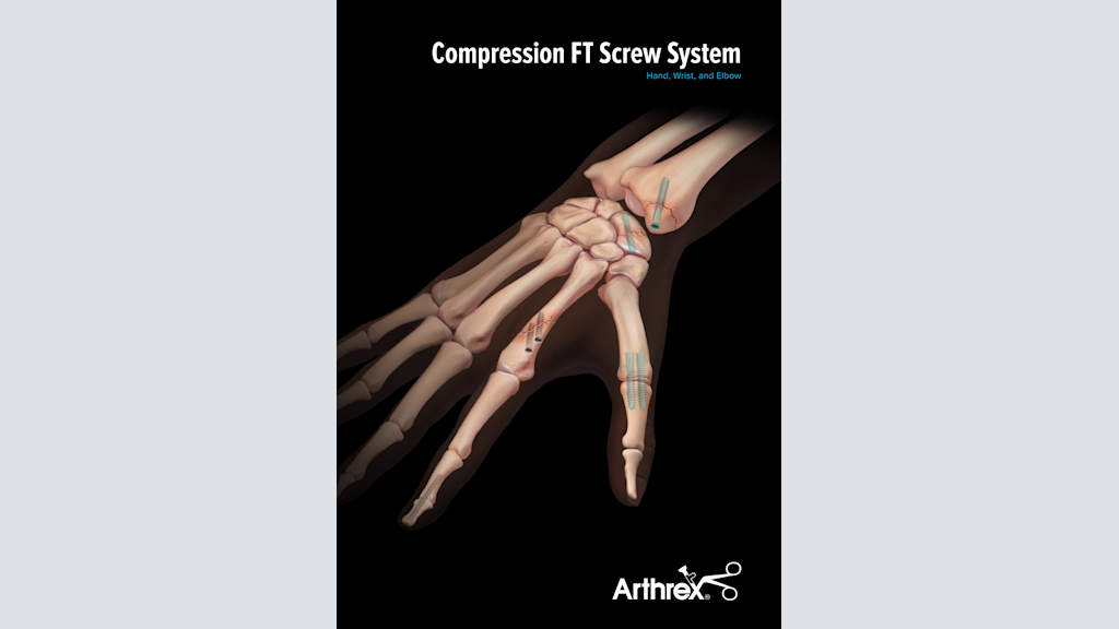Compression FT Screw System - Hand, Wrist and Elbow
