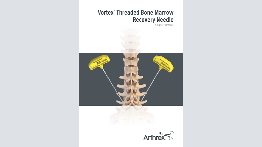 Vortex™ Threaded Bone Marrow Recovery Needle