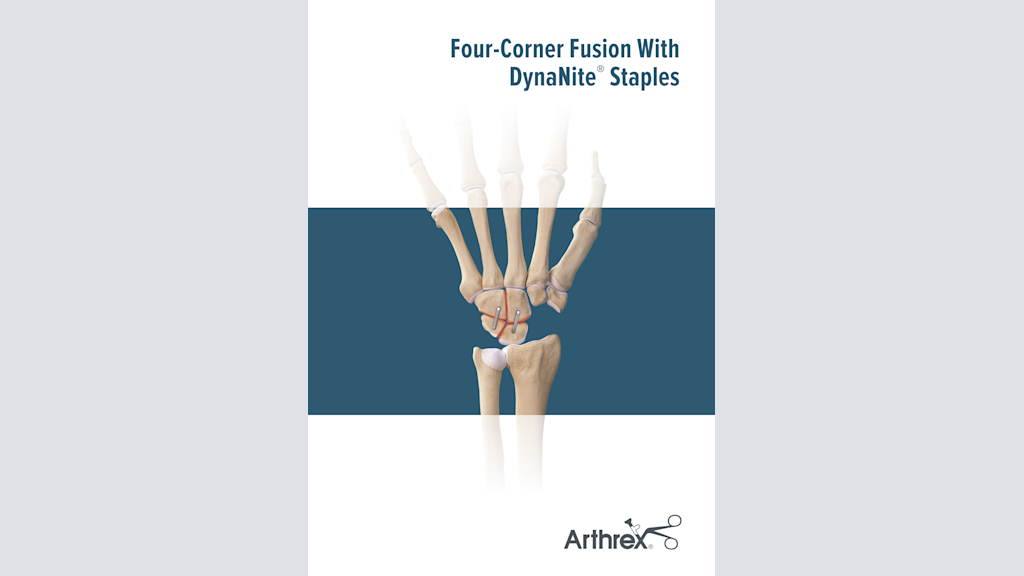 Four-Corner Fusion With DynaNite® Staples