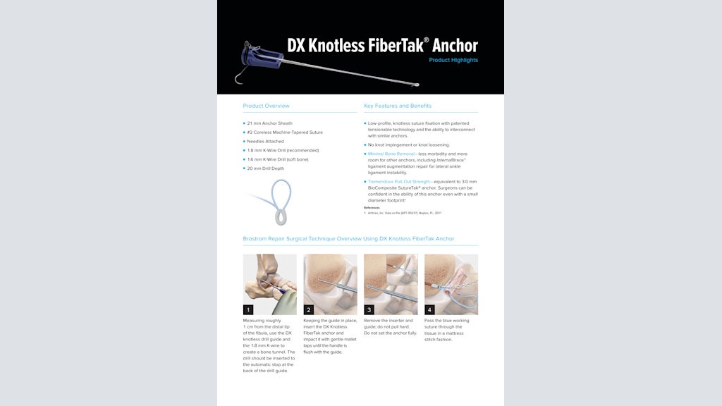 DX Knotless FiberTak® Anchor