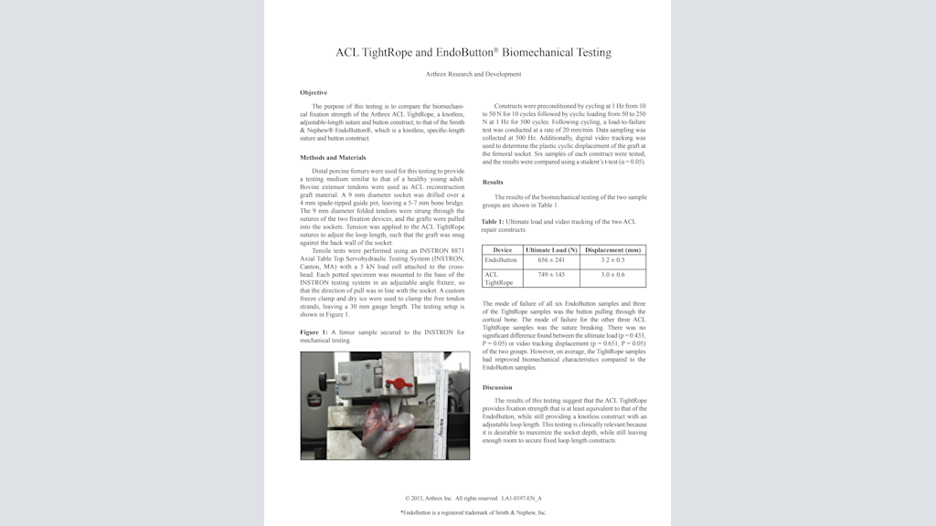 ACL TightRope® and EndoButton Biomechanical Testing