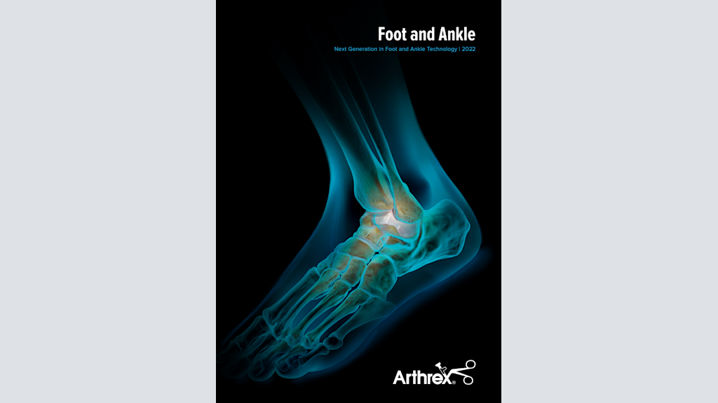 Foot and Ankle: Next Generation in Foot and Ankle Technology 2022