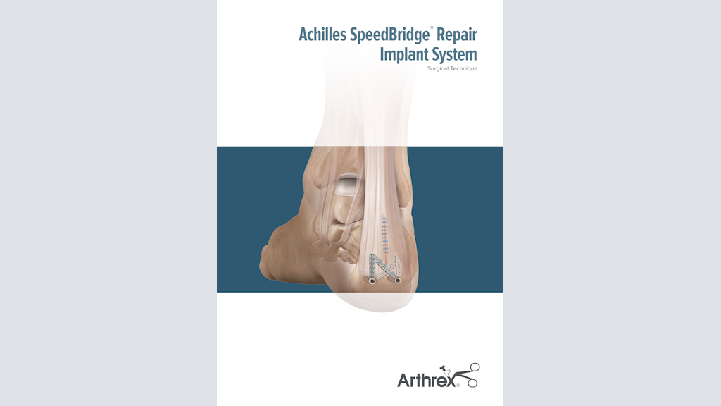 Achilles SpeedBridge™ Repair Implant System