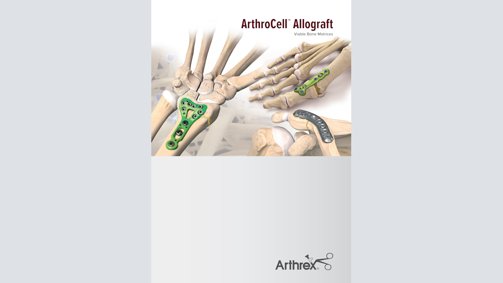 ArthroCell™ Allograft Viable Bone Matrices
