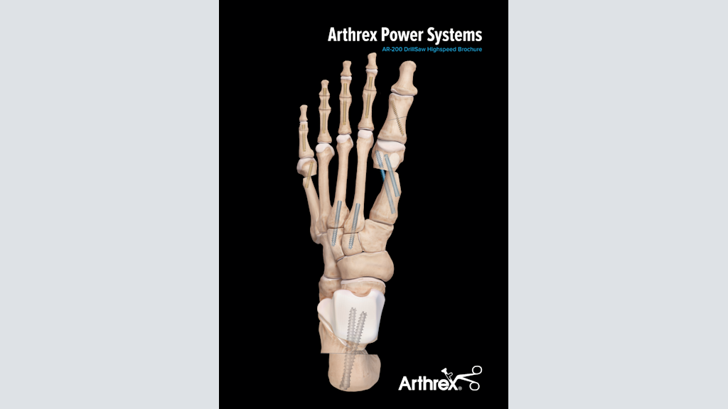 Arthrex Power Systems - AR-200 DrillSaw Highspeed Brochure