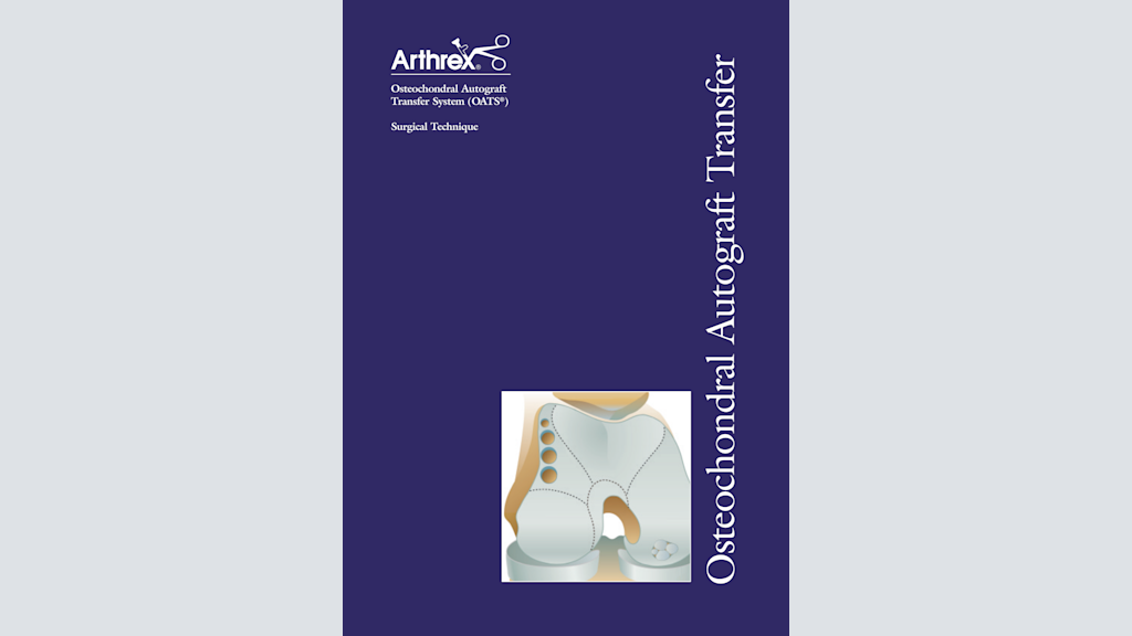 Osteochondral Autograft Transfer System (OATS®)