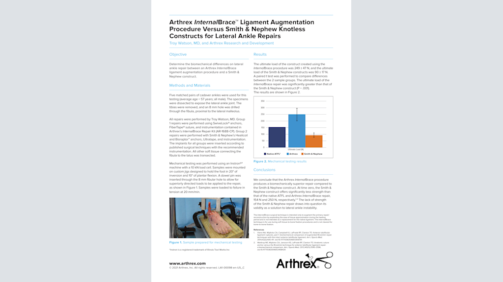 Arthrex InternalBrace™ Ligament Augmentation Procedure Versus Smith & Nephew Knotless Constructs for Lateral Ankle Repairs