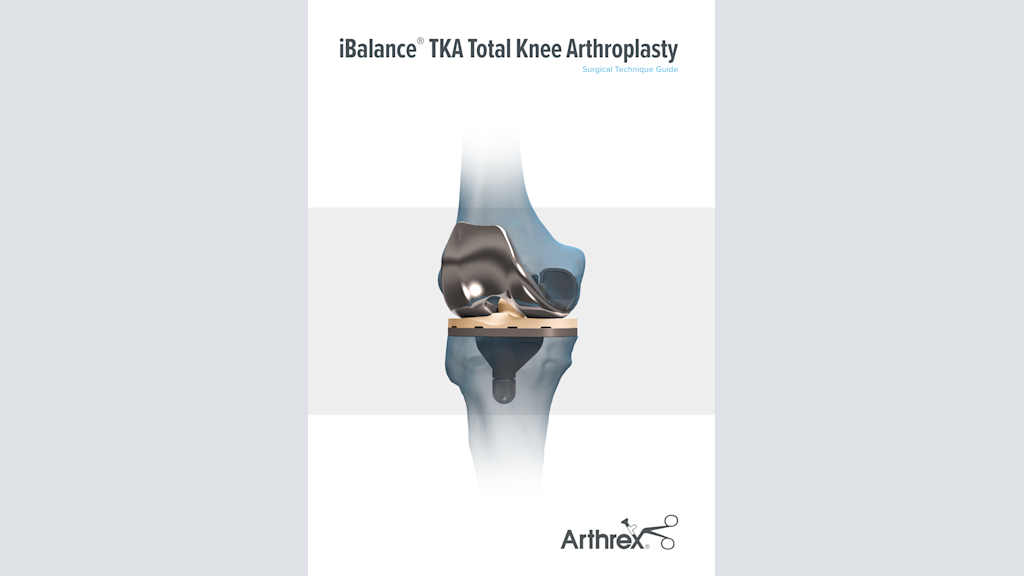 iBalance® TKA Total Knee Arthroplasty
