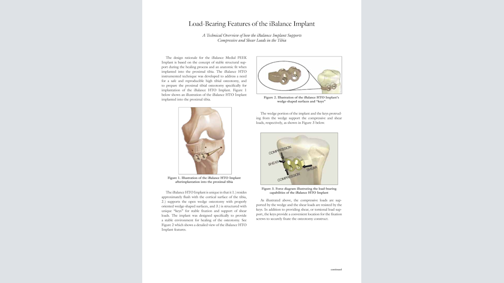 Load-Bearing Features of the iBalance® Implant - A Technical Overview of how the iBalance® Implant Supports Compressive and Shear Loads in the Tibia