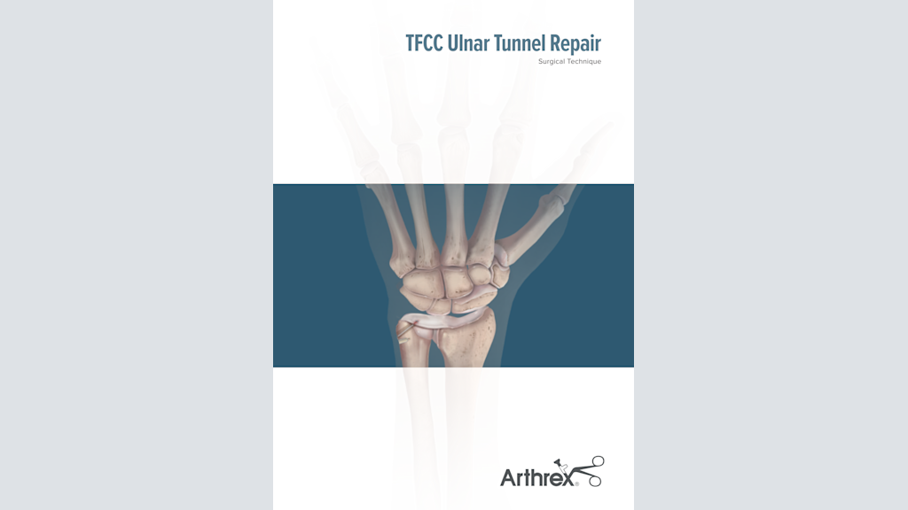 TFCC Ulnar Tunnel Repair