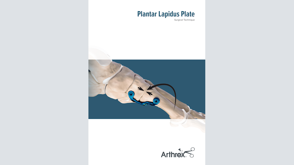 Plantar Lapidus Plate