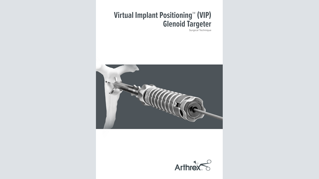 Virtual Implant Positioning™ (VIP) Glenoid Targeter