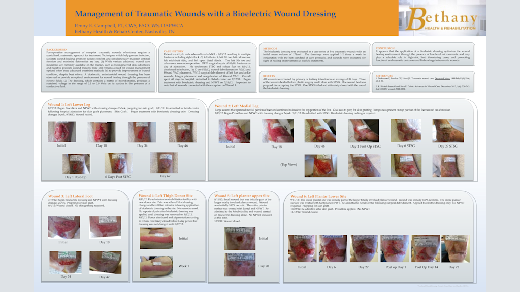 Management of Traumatic Wounds with a Bioelectric Wound Dressing