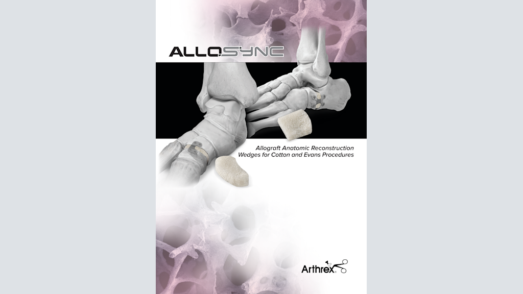 AlloSync™ Allograft Anatomic Reconstruction Wedges for Cotton and Evans Procedures