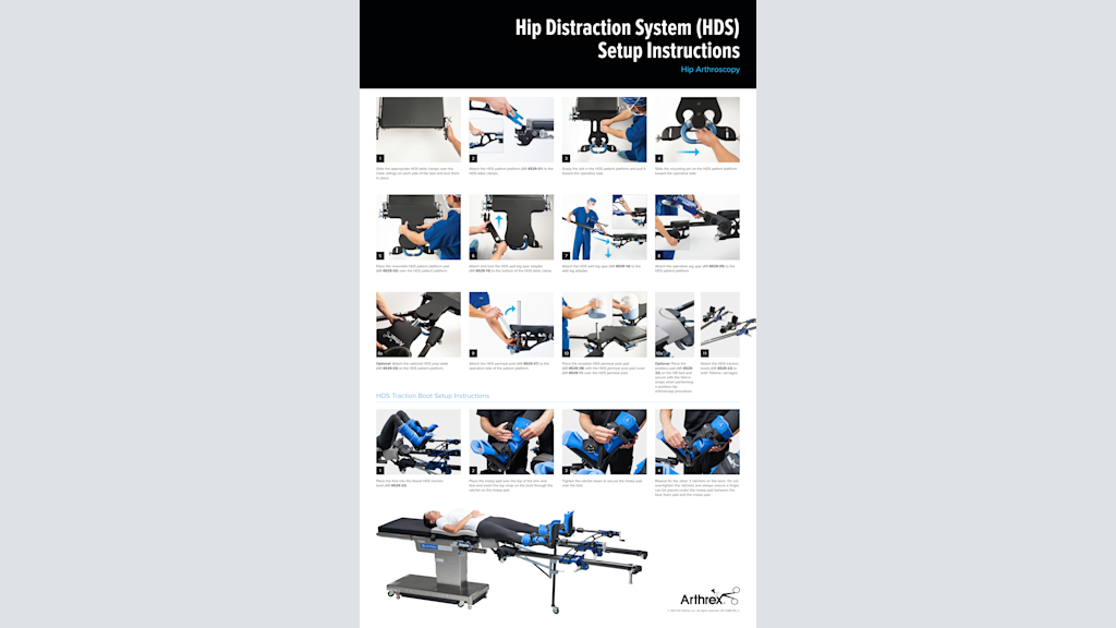 Hip Distraction System (HDS) Setup Instructions