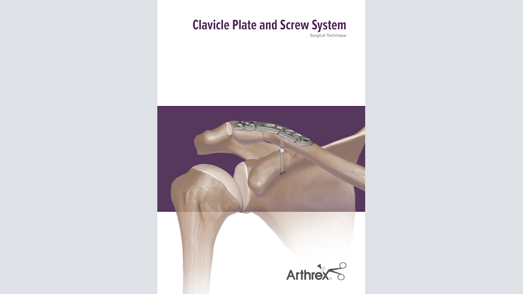 Clavicle Plate and Screw System Surgical Technique