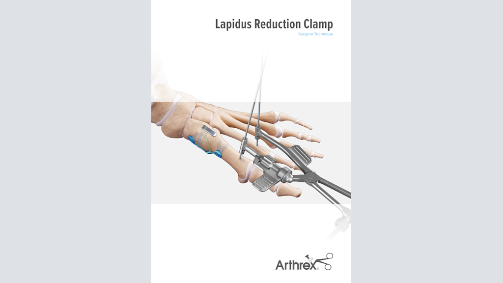 Lapidus Reduction Clamp