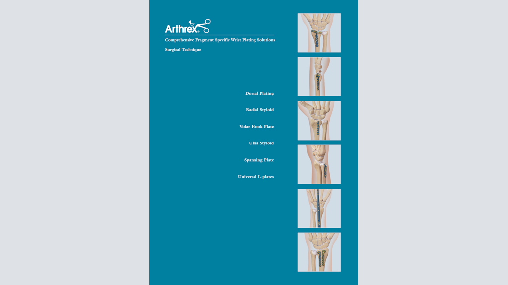 Comprehensive Fragment Specific Wrist Plating Solutions
