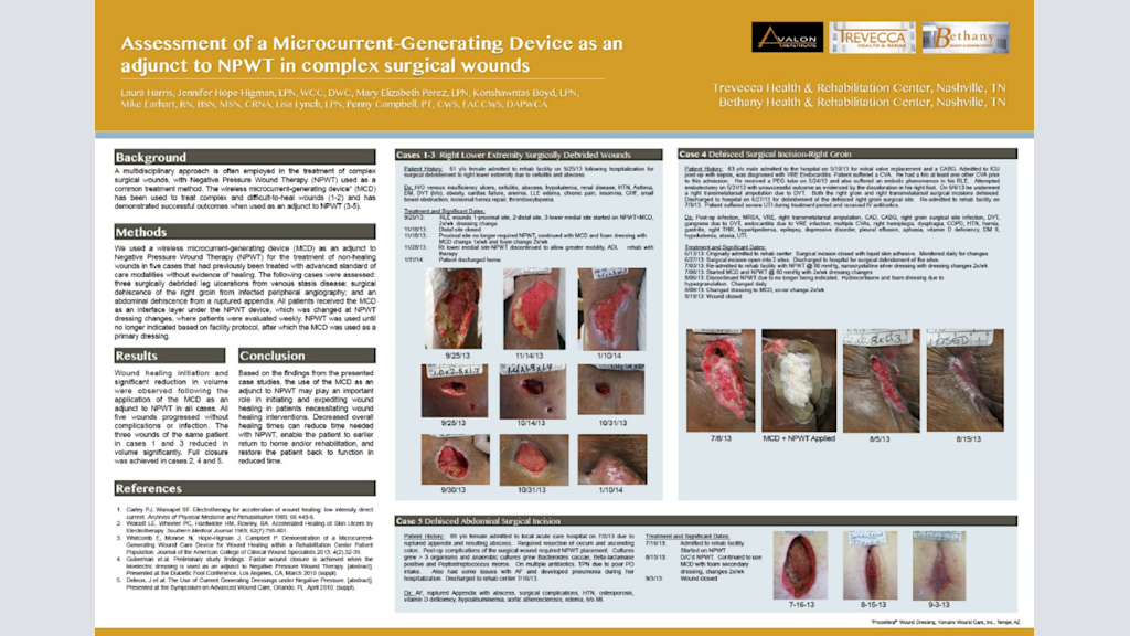 Assessment of a Microcurrent-Generating Device as an adjunct to NPWT in complex surgical wounds