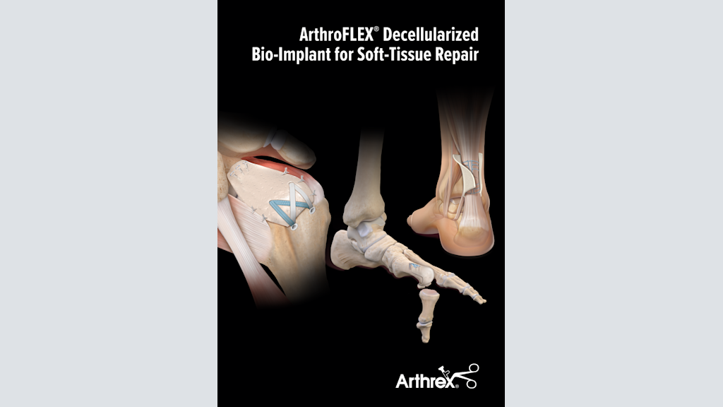 ArthroFLEX® Decellularized Bio-Implant for Soft-Tissue Repair