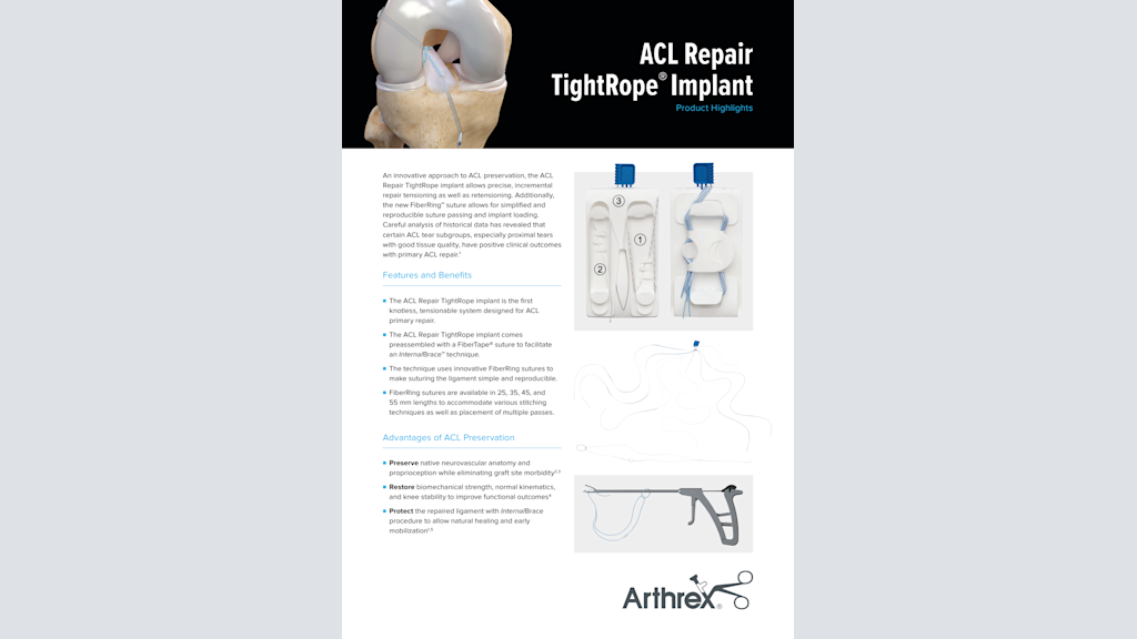 ACL Repair TightRope® Implant