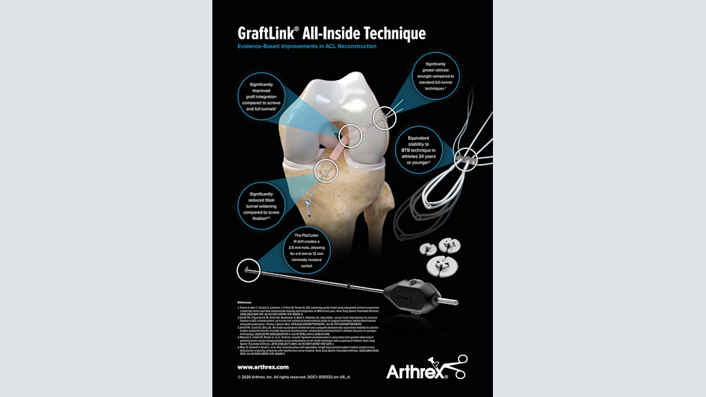 GraftLink® All-Inside Technique Evidence-Based Improvements in ACL Reconstruction