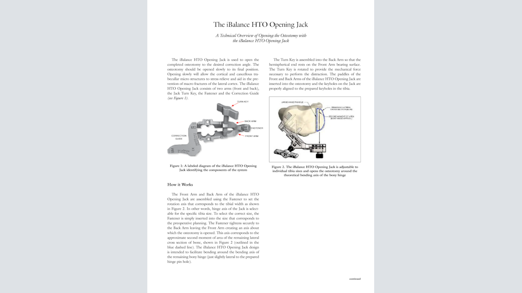The iBalance® HTO Opening Jack - A Technical Overview of Opening the Osteotomy with the iBalance® HTO Opening Jack