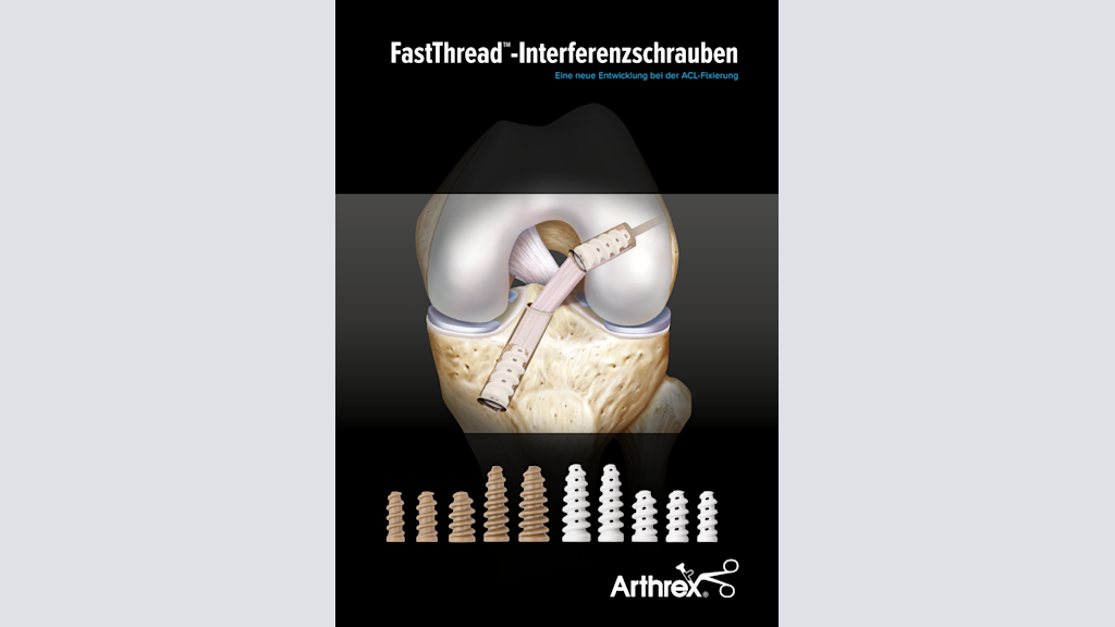 FastThread™-Interferenzschrauben