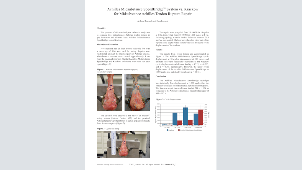 Achilles Midsubstance SpeedBridge™ System vs. Krackow for Midsubstance Achilles Tendon Rupture Repair