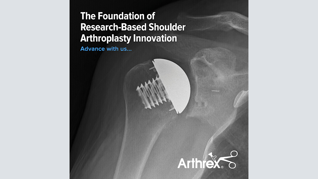 The Foundation of Research-Based Shoulder Arthroplasty Innovation