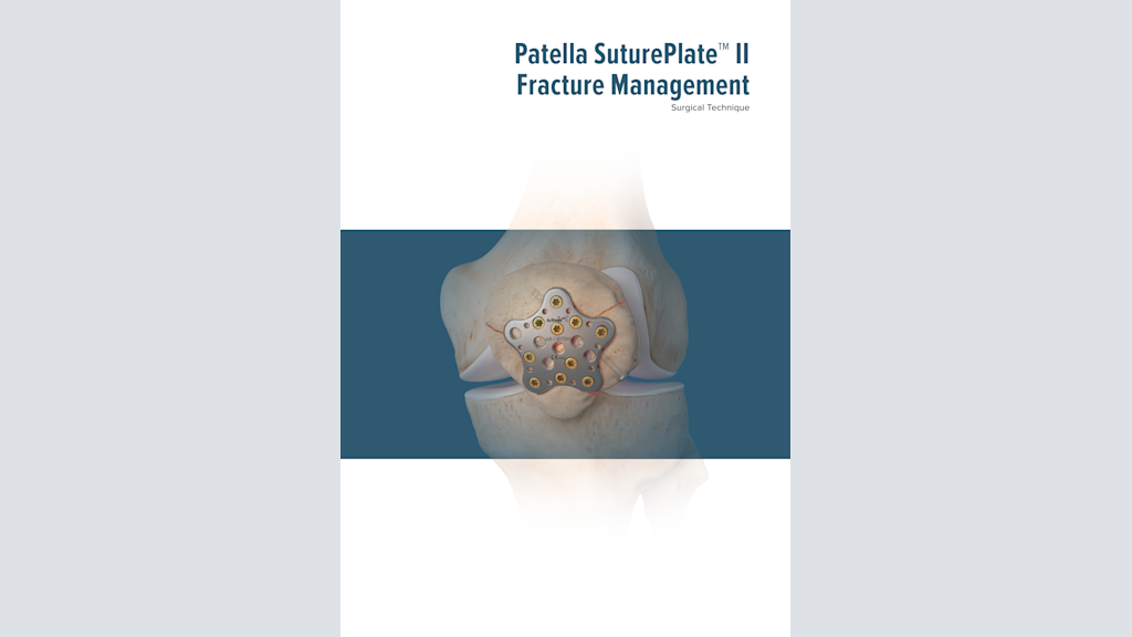 Patella SuturePlate™ II Fracture Management