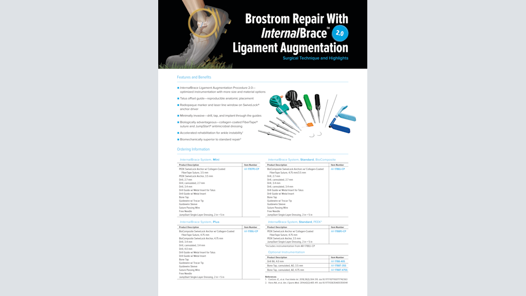 Brostrom Repair With InternalBrace™ 2.0 Ligament Augmentation