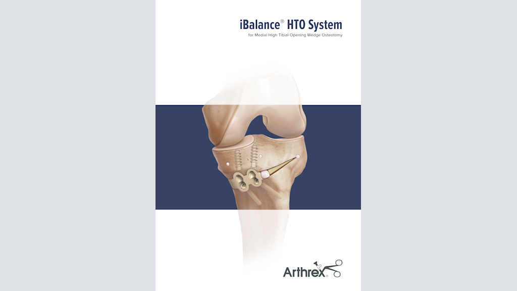 iBalance® HTO System for Medial High Tibial Opening Wedge Osteotomy