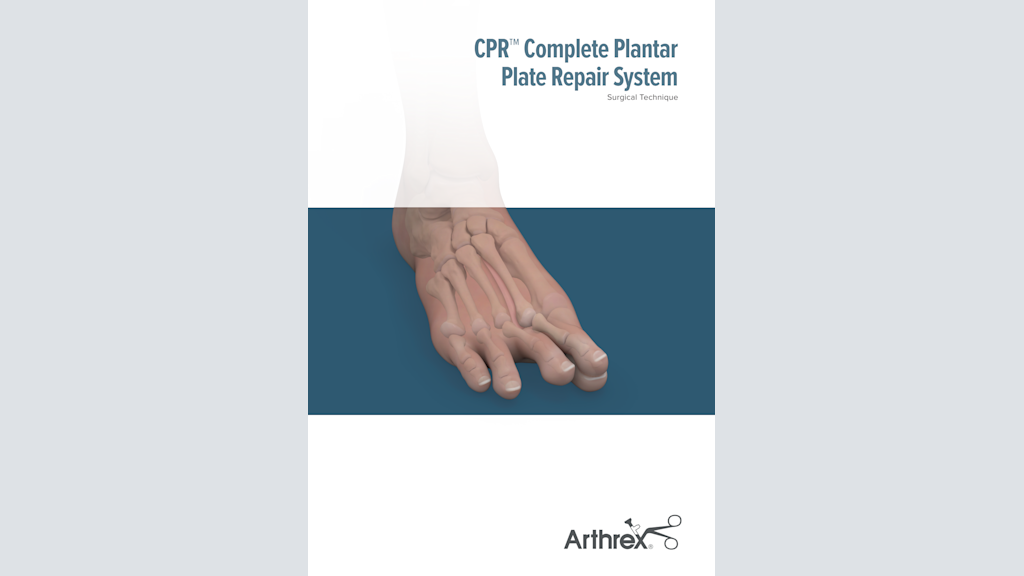 CPR™ Complete Plantar Plate Repair System