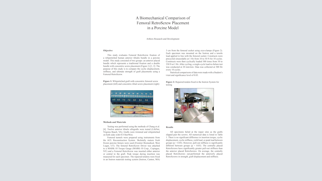A Biomechanical Comparison of Femoral RetroScrew® Placement in a Porcine Model