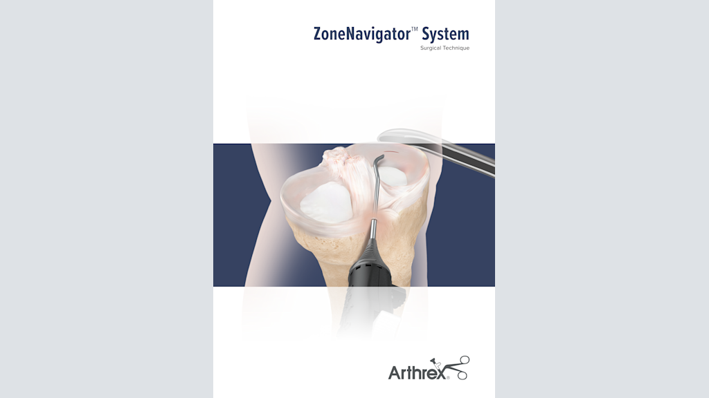 ZoneNavigator™ System