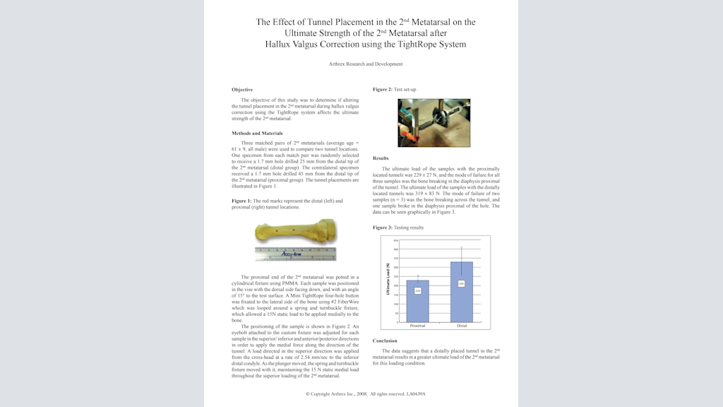The Effect of Tunnel Placement in the 2nd Metatarsal on the Ultimate Strength of the 2nd Metatarsal after Hallux Valgus Correction using the TightRope® System