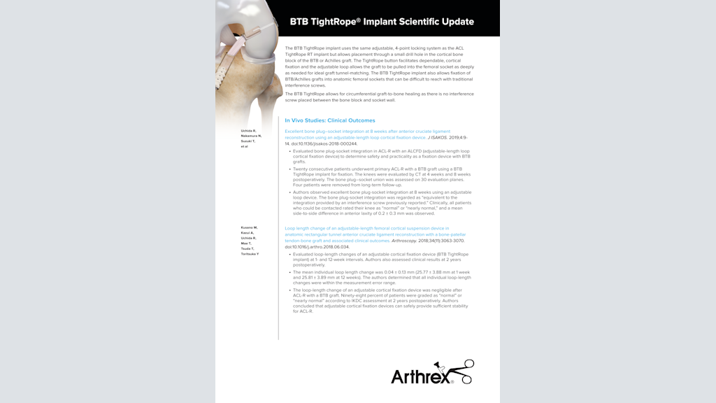 BTB TightRope® Implant Scientific Update