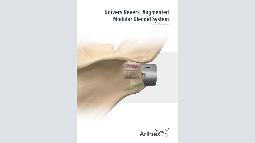 Univers Revers™ Augmented Modular Glenoid System