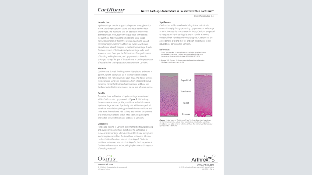 Native Cartilage Architecture is Preserved within Cartiform®