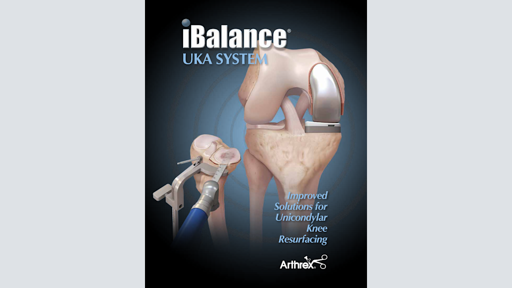 iBalance® UKA System