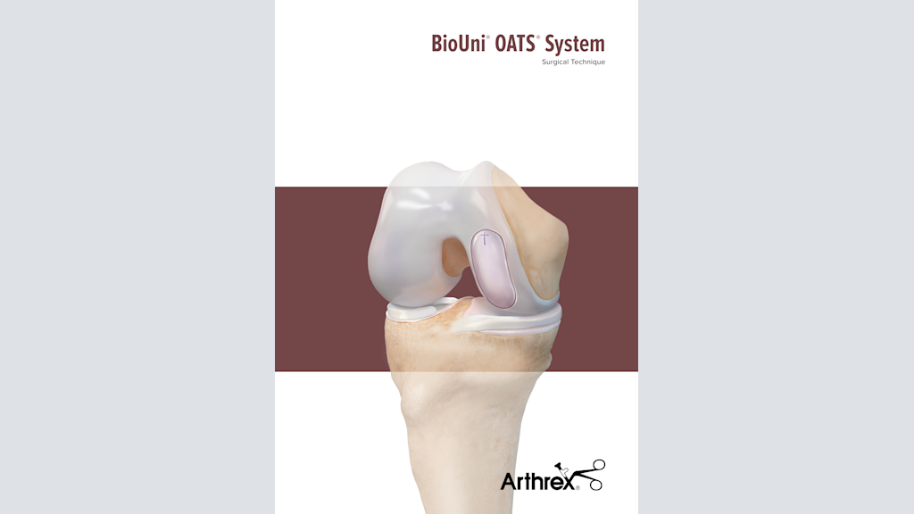 BioUni® OATS® System Surgical Technique