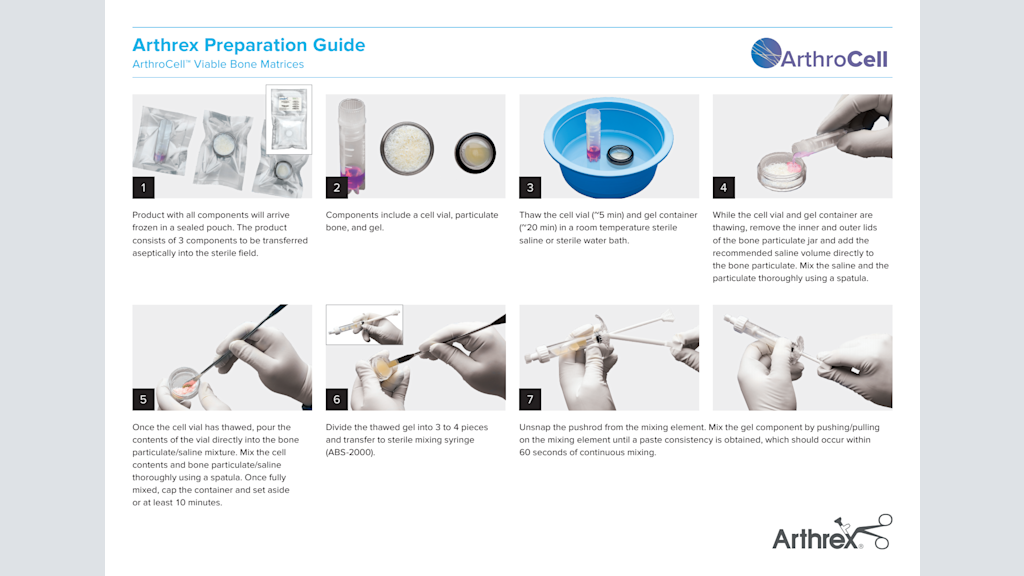 Arthrex Preparation Guide - ArthroCell™ Viable Bone Matrices