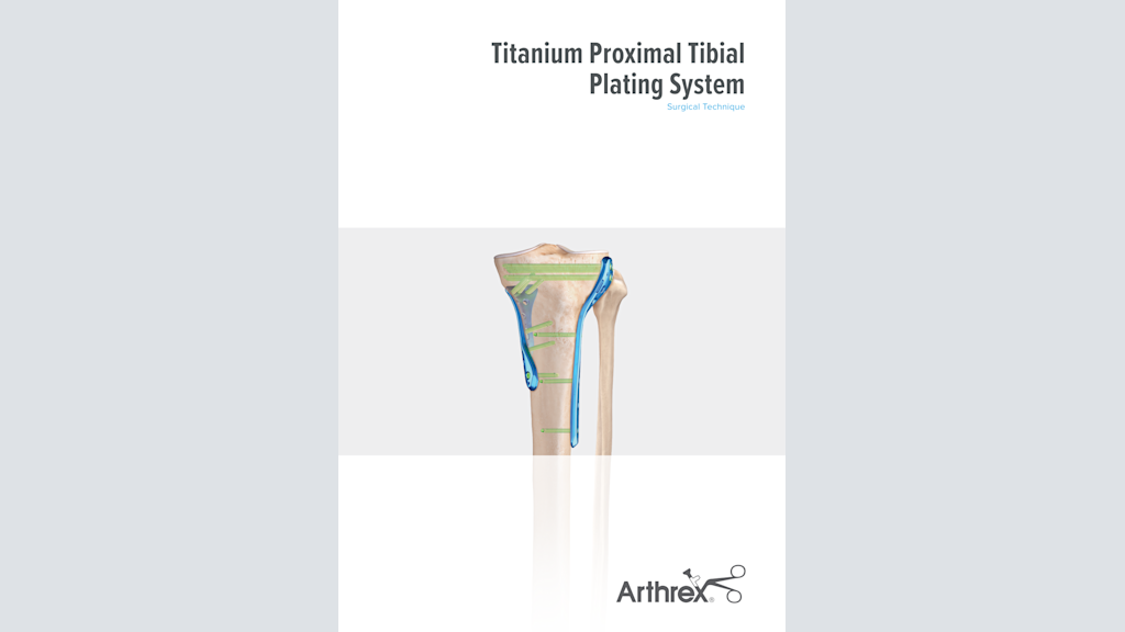 Titanium Proximal Tibial Plating System